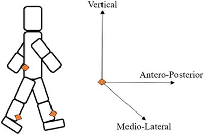 Identification of Characteristic Motor Patterns Preceding Freezing of Gait in Parkinson’s Disease Using Wearable Sensors